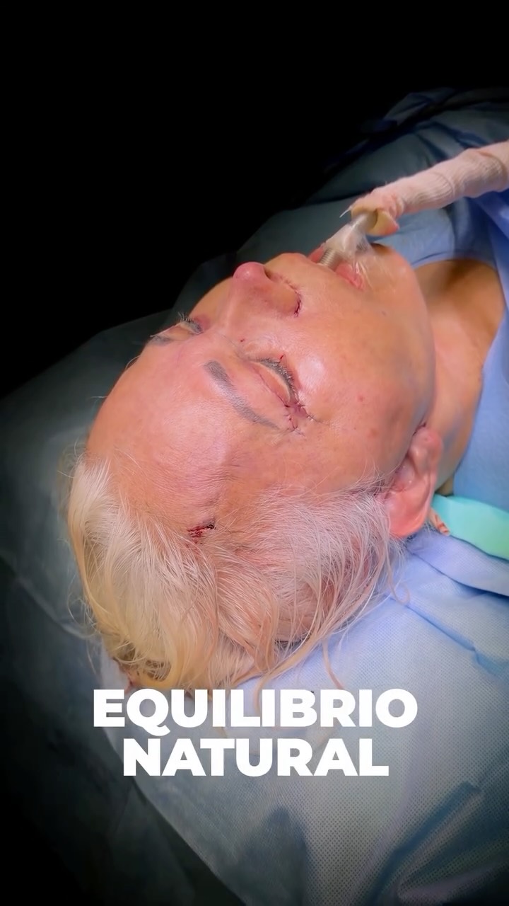 Instagram post from drgalaso. This post is in position 2.