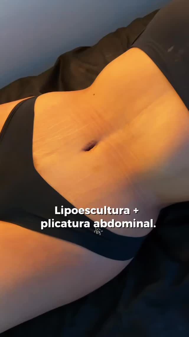 Instagram post from drgalaso. This post is in position 2.