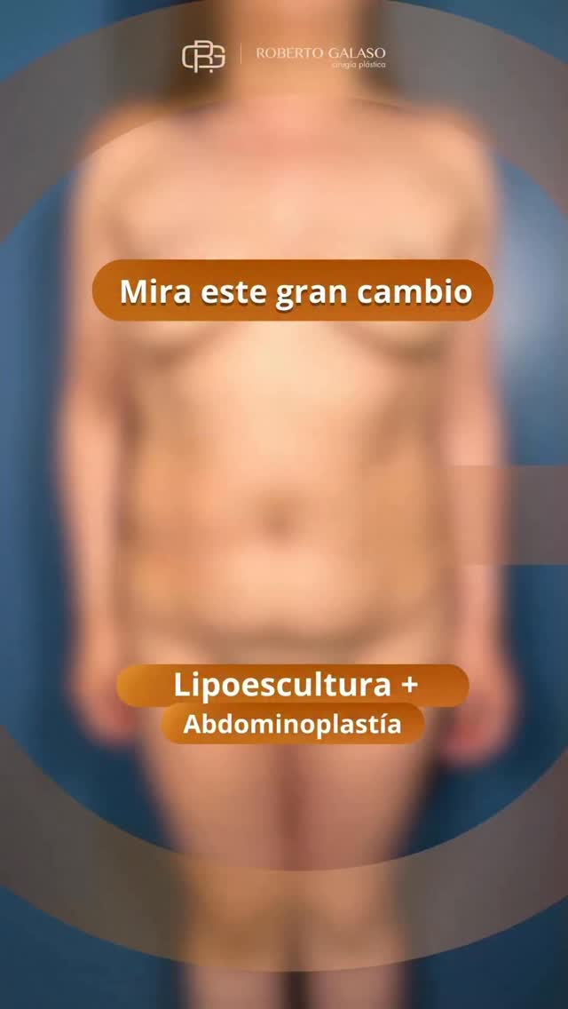 Instagram post from drgalaso. This post is in position 1.