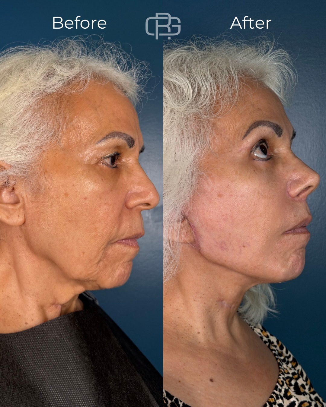 Instagram post from drgalaso. This post is in position 2.